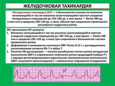 Причины увеличенного сердечного ритма у ребенка и необходимость обратиться к врачу
