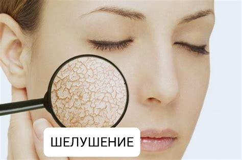 Проблема с кожей за ушами: причины шелушения и правила ухода