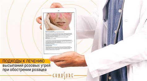 Профессиональные подходы к лечению мелких высыпаний на коже выше локтя