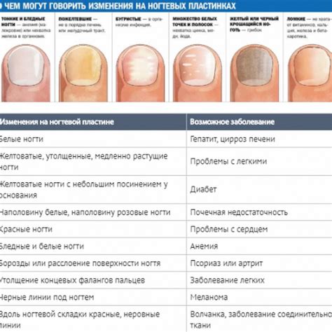 Профилактика заболеваний ногтей: основные меры