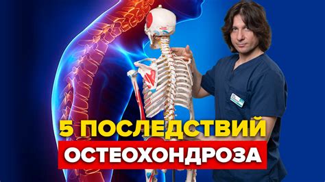 Профилактика и снятие неприятных последствий остеохондроза при обратном положении тела