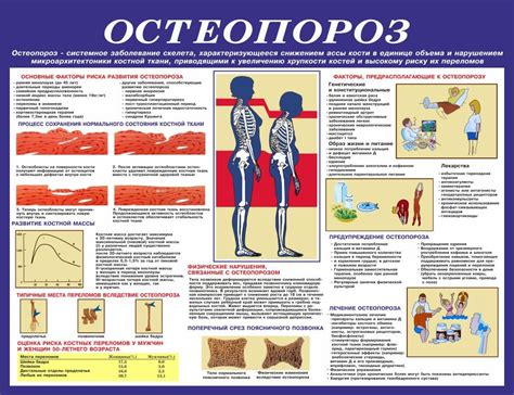 Профилактика остеопороза