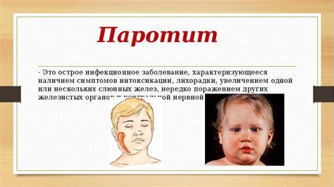Профилактика паротита у маленьких пациентов: важные рекомендации для заботливых родителей