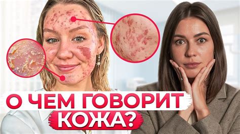 Профилактика появления проблемы на коже: рекомендации специалиста
