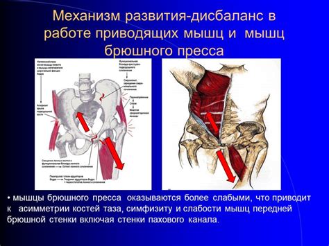 Путь к восстановлению связки в паховой области: важные аспекты реабилитации