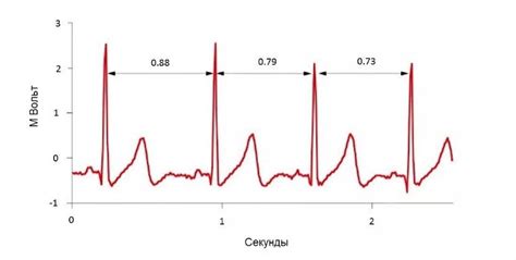 Работа с датчиком сердечного ритма: настройка и использование