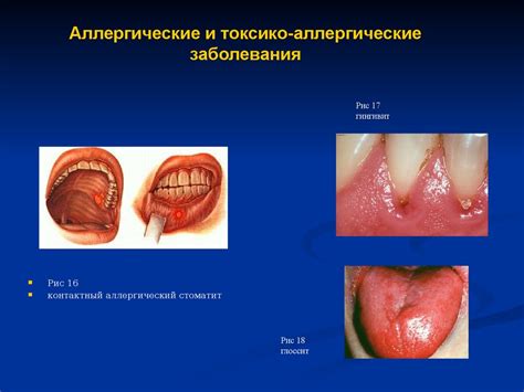 Раздражение и повреждение слизистой оболочки