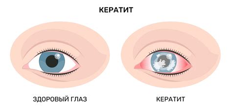 Различные заболевания, вызывающие неудобства в глазах