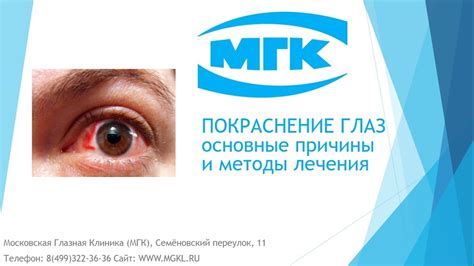Различные заболевания глаз, вызывающие дергание