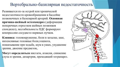 Расстройства вертебро-базилярной артерии