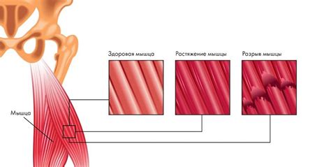 Растяжение мышц - долгосрочный подход к увеличению гибкости