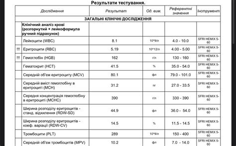 Расшифровка сигналов датчика автогаза: анализ данных