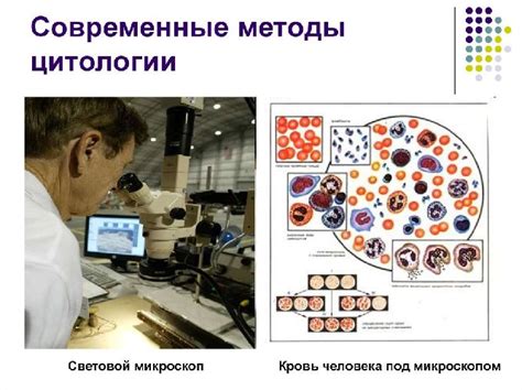 Революционное открытие: эра микробов М. Шлейдена