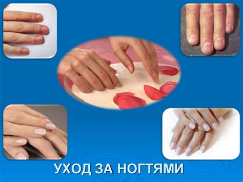 Регулярный уход за ногтями и кожей рук