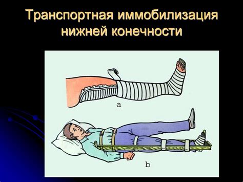 Рекомендации по восстановлению после повреждения предней части нижней конечности