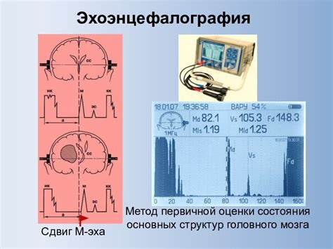 Рентгенография черепа: эффективный метод оценки состояния центральной нервной системы