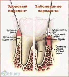 Роль десен в организме ребенка