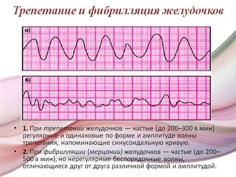 Роль слаженного сердечного ритма в нормальном функционировании сердца