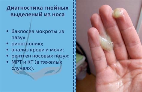 Самостоятельное лечение гноя