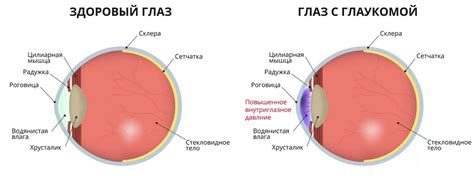 Связь между глазным давлением и заболеваниями глаз