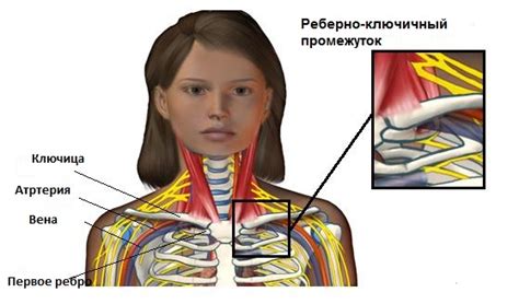 Сдавление сосудов и нервов