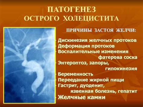 Симптоматика и причины уплотнения желчи