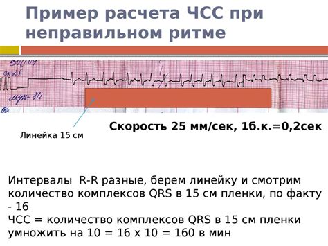 Симптомы, указывающие на высокую частоту сердечных сокращений