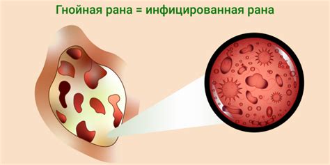 Симптомы гноя в ране