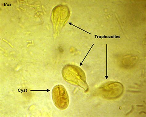 Симптомы инфекции Entamoeba coli у маленького ребенка