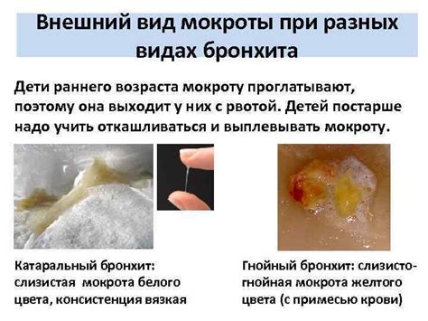 Симптомы и внешний вид мокроты у детей разных возрастов