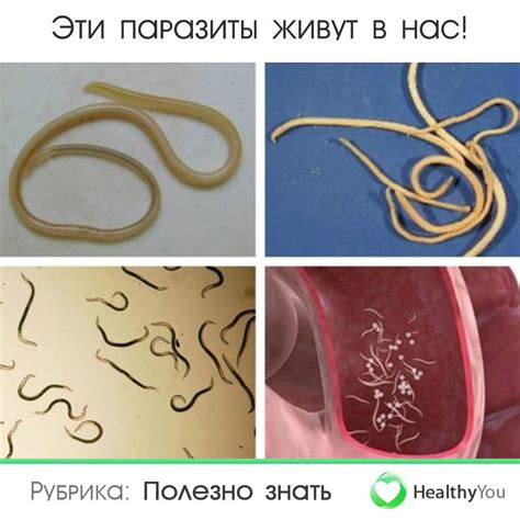 Симптомы и последствия заражения глистами