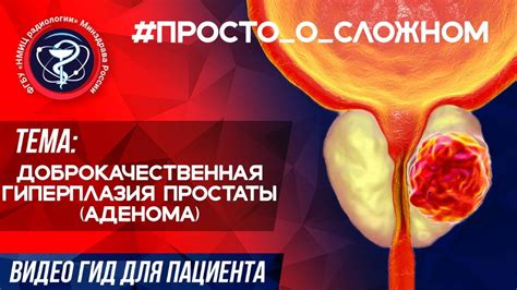 Симптомы и признаки нервной инвазии при онкологическом поражении предстательной железы
