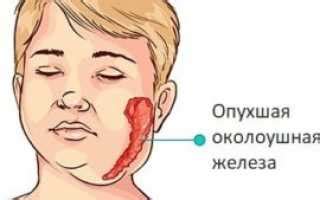 Симптомы и признаки образования подъязычной опухоли: как распознать возникшую проблему