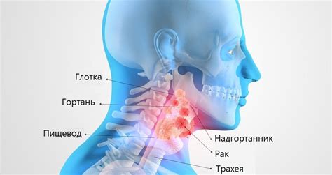 Симптомы и причины горла