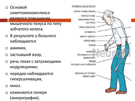 Синдром сонной параличи: особенности и взаимосвязь с сном
