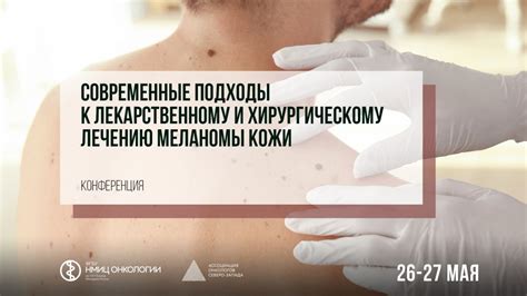 Современные подходы к лечению пигментных нарушений кожи