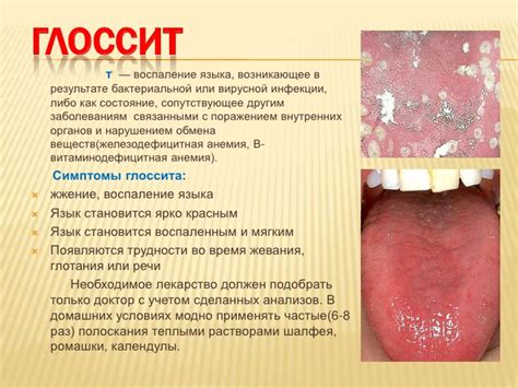 Способы изучения глоссит языка