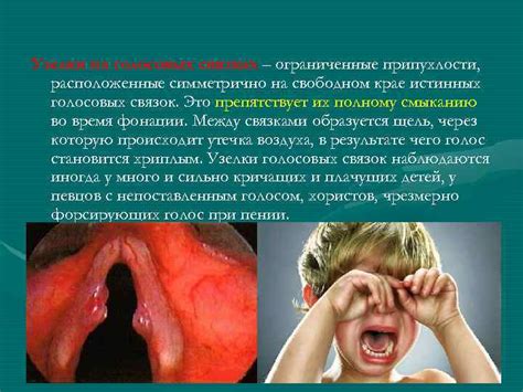 Сравнение голоса и манеры речи: находите индивидуальные особенности