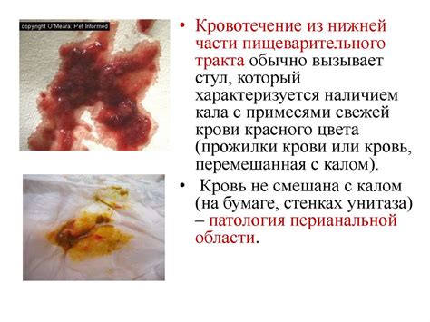 Стул голубя: достаточно серьезный симптом