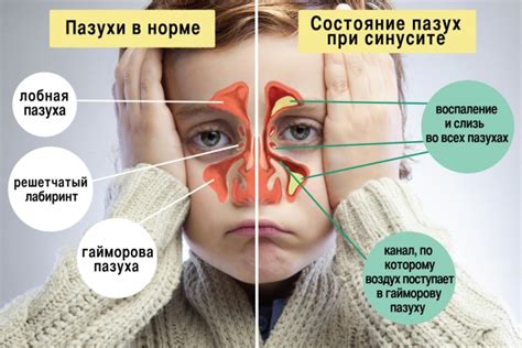 Сухой нос: причины и последствия