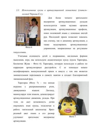 Техника эффективной артикуляции и ее развитие с помощью шарика