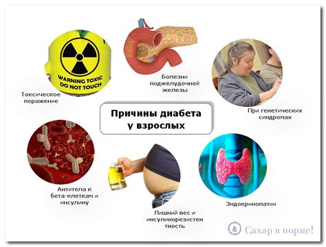 Угроза возникновения сахарного диабета