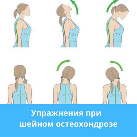 Укрепление мышц шеи с помощью регулярных физических упражнений