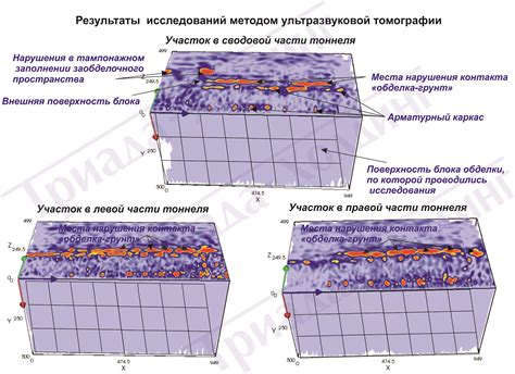 Ультразвуковая томография - точный и безопасный способ определения жирового слоя