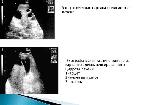 Ультразвуковое исследование мочевых органов