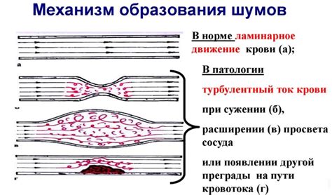 Установка и причины гнутости