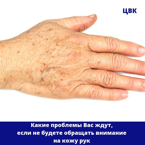 Уход за стыками: первоначальное внимание и регулярные процедуры