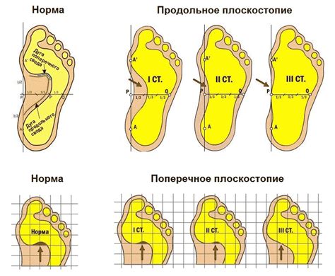 Учтите особенности ноги и стопы ребенка