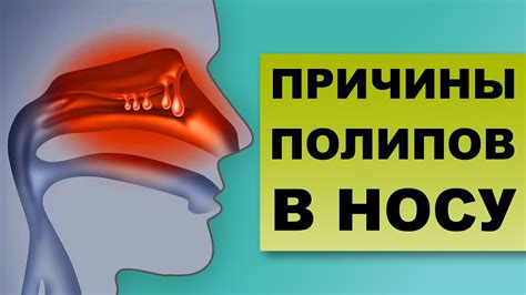 Факторы, мешающие нормализации водного баланса в носу
