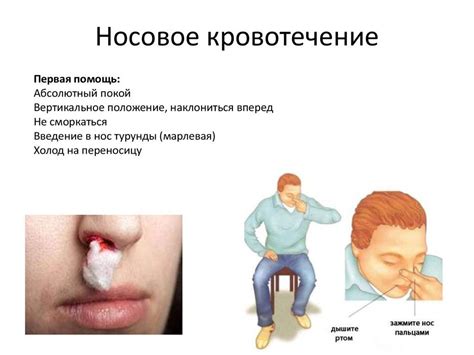 Факторы, способствующие возникновению эпистаксиса: основные причины кровотечения из носа